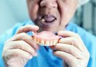 São Gonçalo amplia atendimento para fornecer prótese dentária a pacientes odontológicos